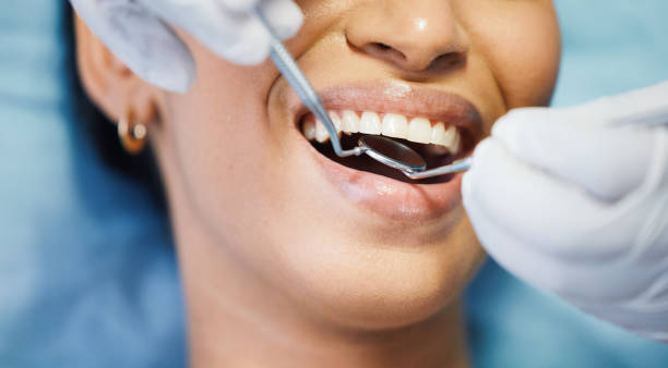 Oral Surgery in Punta Gorda, FL